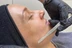 Dermaplane facial treatment