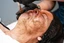Skin treatments